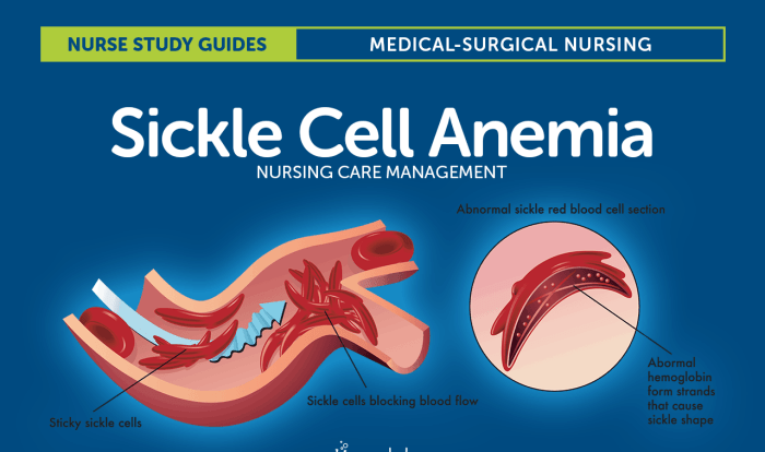 Nclex questions on sickle cell anemia