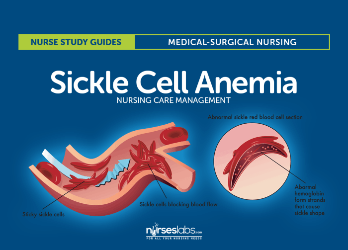 Nclex questions on sickle cell anemia