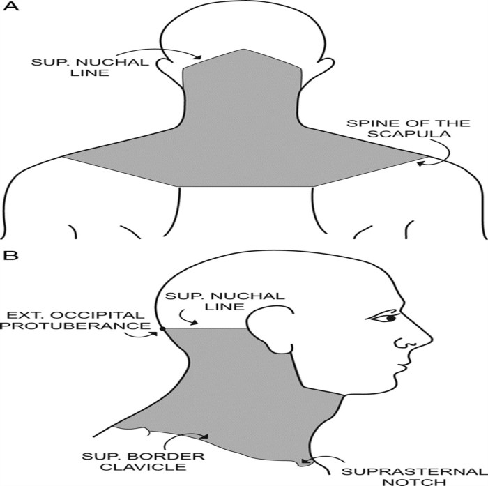 Pains in the neck crossword