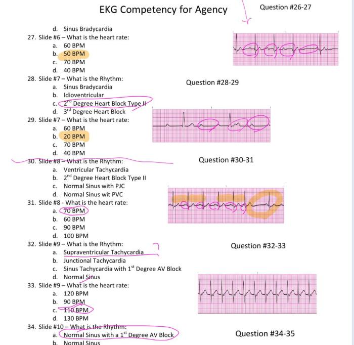 Impulse 3.0 chest pain competency series answers